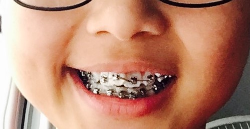 20170228_075247000_ios